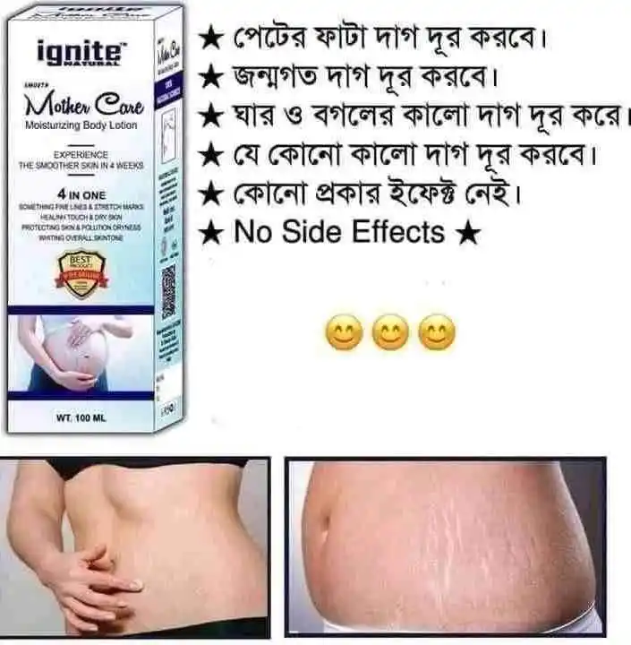 ignite mother care lotion