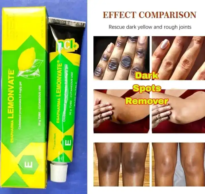যে কোন কালো দাগ দূর করার ক্রিম ESAPHARMA LEMONVATE Gel