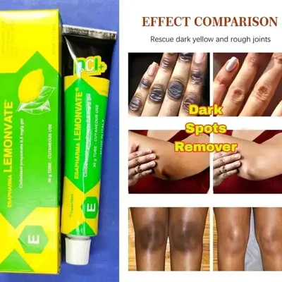 যে কোন কালো দাগ দূর করার ক্রিম ESAPHARMA LEMONVATE Gel